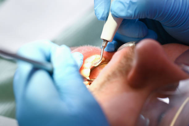 Best Pediatric Emergency Dentist in Muncie, IN
