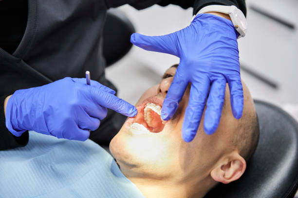 Best Emergency Tooth Extraction in Muncie, IN